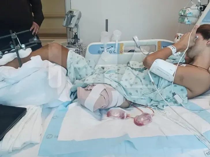 Stavros Floros Sues ‘Survivor Greece’ Producers for $100 Million After Losing Leg in Boat Accident 51 Stavros Floros Survivor Greece lawsuit after boat accident